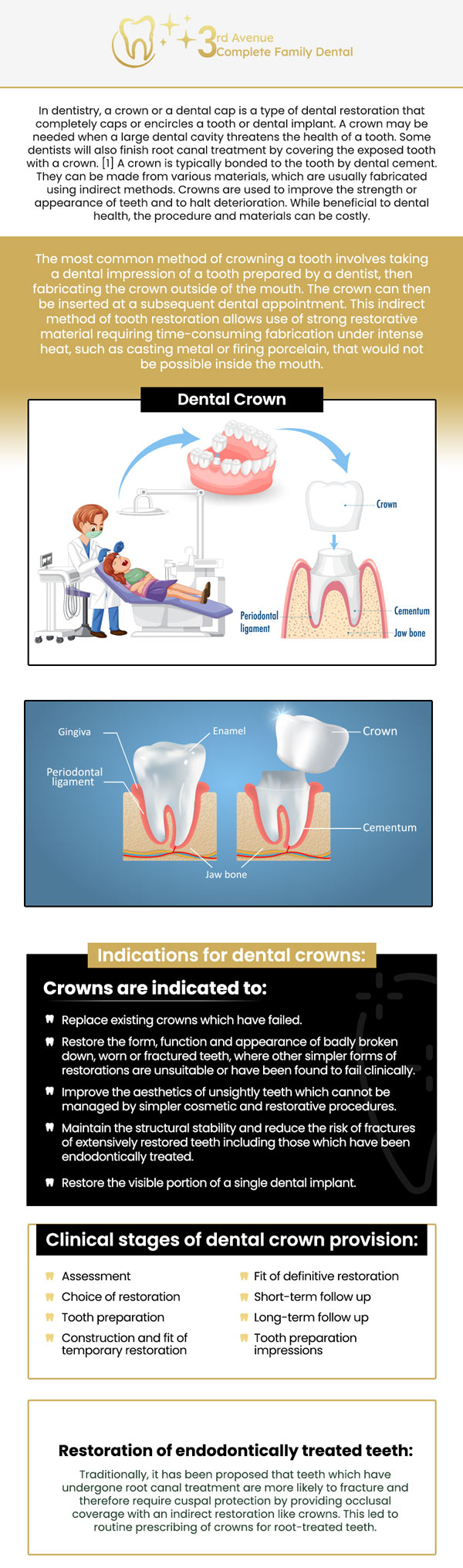The cost of a new dental crown in San Diego typically ranges from $800 to $1,500. The price may vary based on the specific needs of each patient, including the tooth's location and condition. At 3rd Avenue Complete Family Dental, Dr. Arthur Abordo offers personalized care to ensure that your dental crown is both affordable and high-quality. Our team will work with you to determine the best treatment option, ensuring you receive the best value for your dental care. For more information, contact us or request an appointment online today! We are located at 3330 3rd Avenue Suite 302 San Diego, CA 92103. The cost of a new dental crown in San Diego typically ranges from $800 to $1,500. The price may vary based on the specific needs of each patient, including the tooth's location and condition. At 3rd Avenue Complete Family Dental, Dr. Arthur Abordo offers personalized care to ensure that your dental crown is both affordable and high-quality. Our team will work with you to determine the best treatment option, ensuring you receive the best value for your dental care. For more information, contact us or request an appointment online today! We are located at 3330 3rd Avenue Suite 302 San Diego, CA 92103.