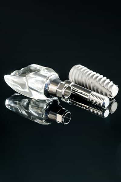 Dental Implants